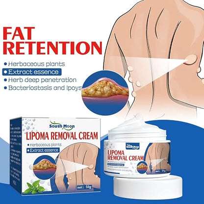 South Moon Lipoma Removal Cream || SUMMER SALE OFFER